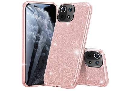 TPU Glitter Case (růžový) - Ochranný kryt s trblietkami pro Xiaomi Mi 11
